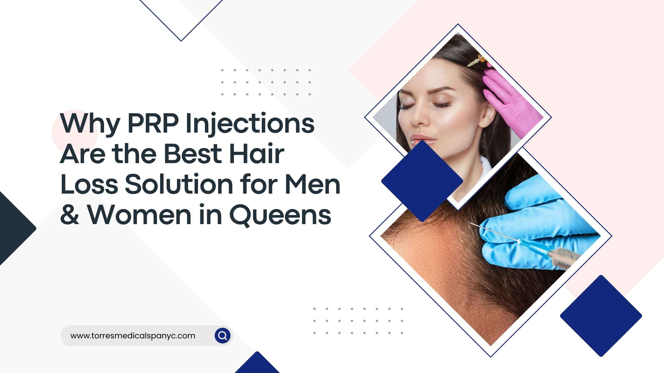 PRP Injections Are the Best Hair Loss Solution