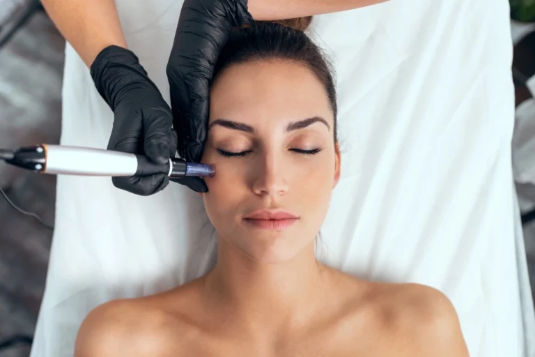 Choosing the Best Clinic for Micro-Needling with PRP in Queens