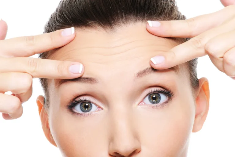 Is Botox right for your forehead wrinkles?