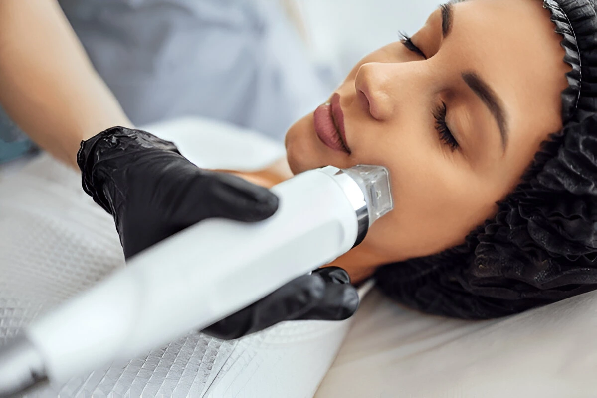 Get Microneedling in Howard Beach
