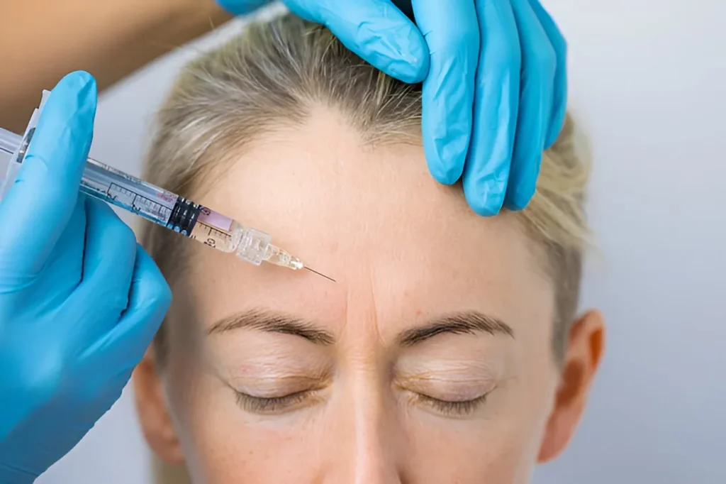 botox for forehead wrinkles